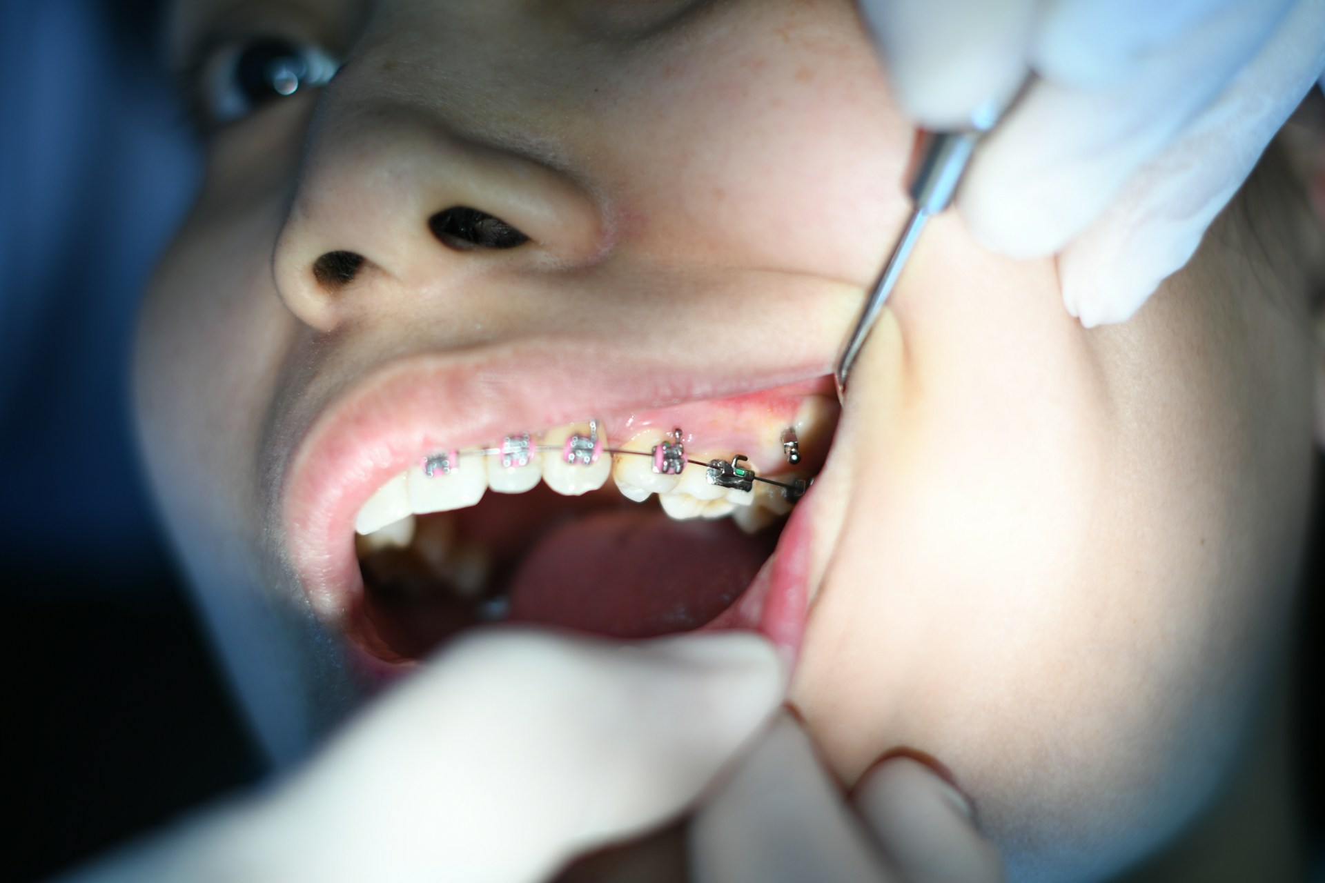 - What Is An Orthodontist? What Do They Do?